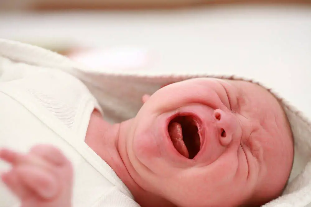 Answering All Your Questions About Tongue-tie and Lip Ties -How They Can Affect Breastfeeding